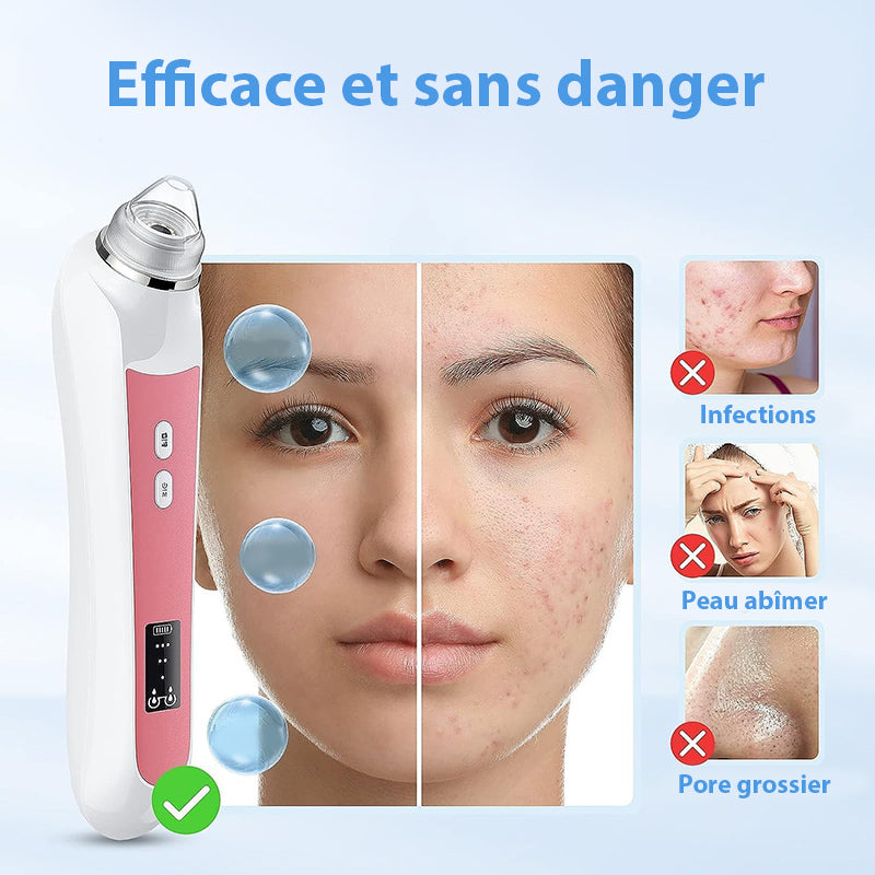 Aspirateur Point Noir avec Camera - Extracteur de impuretés & Nettoyeur de Pores de qualité, technologie intelligente
