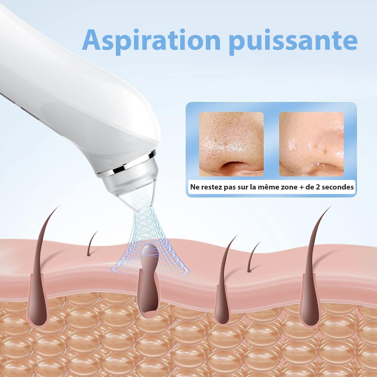 Aspirateur Point Noir avec Camera - Extracteur de impuretés & Nettoyeur de Pores de qualité, embouts interchangeables