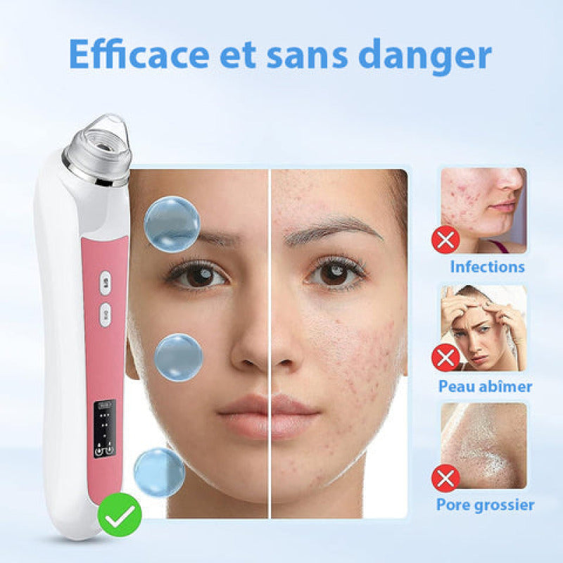 Aspirateur point noir avec caméra HD, 6 embouts, nettoyage de qualité des pores, utilisation sans fil et batterie longu...